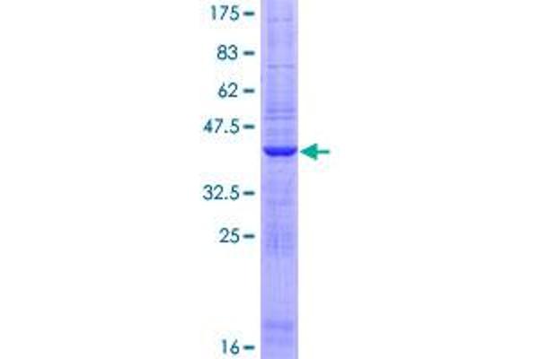 FARP1 Protein (AA 1-129) (GST tag)