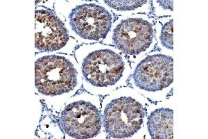 IHC analysis of TTLL2 using anti-TTLL2 antibody (ABIN7600850).