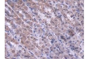 Detection of MTX1 in Rat Stomach Tissue using Polyclonal Antibody to Metaxin 1 (MTX1) (Metaxin 1 Antikörper  (AA 163-324))