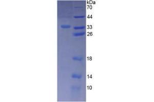 SDS-PAGE (SDS) image for Aurora Kinase C (AURKC) (AA 20-277) protein (His tag) (ABIN6238706) (Aurora Kinase C Protein (AURKC) (AA 20-277) (His tag))