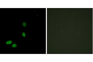 Immunofluorescence analysis of HeLa cells, using HMG17 antibody. (HMGN2 Antikörper)