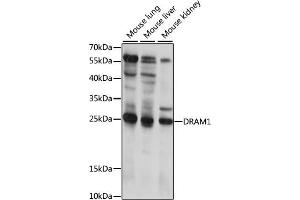 Western blot analysis of extracts of various cell lines, using DR antibody (ABIN7266817) at 1:1000 dilution. (DRAM Antikörper  (AA 100-200))