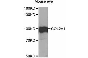 Western blot analysis of extracts of mouse eye, using COL2A1 antibody (ABIN1871948) at 1:1000 dilution. (COL2A1 Antikörper)