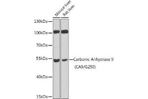 Western blot analysis of extracts of various cell lines, using Carbonic Anhydrase 9 (C/G250) antibody (ABIN6131267, ABIN6137799, ABIN6137801 and ABIN6218748) at 1:100 dilution. (CA9 Antikörper  (AA 52-151))