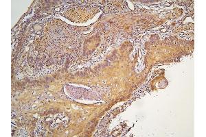 IHC analysis of HOOK3 using anti-HOOK3 antibody (ABIN6719547). (HOOK3 Antikörper  (AA 14-198))