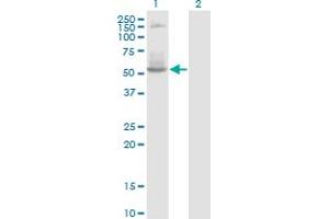 Western Blot analysis of DNTT expression in transfected 293T cell line by DNTT monoclonal antibody (M01), clone 4H5.