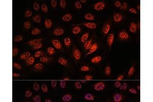 Immunofluorescence analysis of U-2 OS cells using RBM25 Polyclonal Antibody at dilution of 1:100. (RBM25 Antikörper)