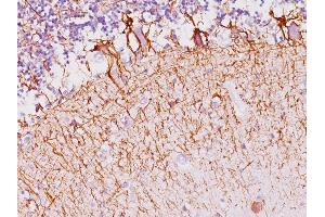 Formalin-fixed, paraffin-embedded human Cerebellum stained with Neurofilament Mouse Monoclonal Antibody (NF421).
