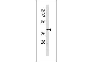 ZFP92 Antibody (N-term) (ABIN1882009 and ABIN2843295) western blot analysis in human Uterus tissue lysates (35 μg/lane). (ZNF92 Antikörper  (N-Term))