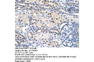 Rabbit Anti-PAIP1 Antibody  Paraffin Embedded Tissue: Human Kidney Cellular Data: Epithelial cells of renal tubule Antibody Concentration: 4. (PAIP1 Antikörper  (C-Term))