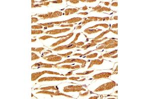 Immunohistochemistry (Paraffin-embedded Sections) (IHC (p)) image for anti-Phosphoglucomutase 1 (PGM1) (AA 469-501) antibody (ABIN6242565)