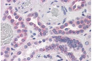 Human Kidney: Formalin-Fixed, Paraffin-Embedded (FFPE) (GPR3 Antikörper  (AA 1-331))