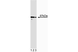 Western blot analysis of ICBP90 on HeLa lysate. (UHRF1 Antikörper  (AA 199-298))