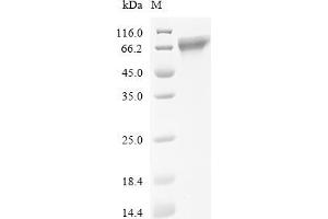 (Tris-Glycine gel) Discontinuous SDS-PAGE (reduced) with 5 % enrichment gel and 15 % separation gel.