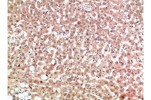 Immunohistochemical analysis of paraffin-embedded human-liver, antibody was diluted at 1:200 (EPG5 Antikörper  (AA 141-190))