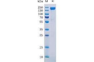 Human CD171 Protein, His Tag on SDS-PAGE under reducing condition.