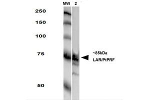 Western Blot analysis of Rat Brain Membrane showing detection of LAR protein using Mouse Anti-LAR Monoclonal Antibody, Clone S165-38 . (PTPRF Antikörper  (AA 1315-1607) (Atto 390))