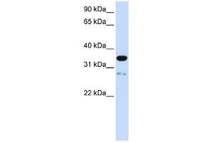 TMEM38A antibody used at 1 ug/ml to detect target protein. (TMEM38A Antikörper  (N-Term))