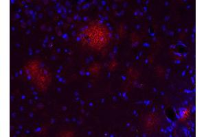 Indirect immunostaining of a PFA fixed formic acid treated brain section from a triple transgenic Alzheimer´s disease mouse (dilution 1 : 500; red).