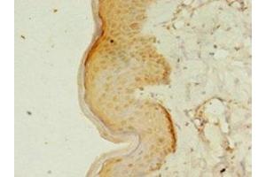 Immunohistochemistry of paraffin-embedded human skin tissue using ABIN7167192 at dilution of 1:100