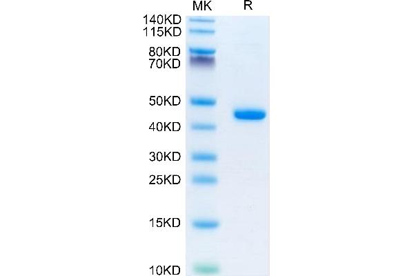 beta-2 Microglobulin Protein (AA 21-119) (Fc Tag)