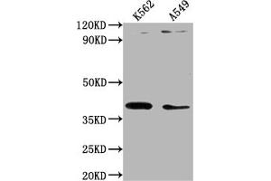 Western Blot Positive WB detected in: K562 whole cell lysate, A549 whole cell lysate All lanes: TMOD1 antibody at 1:1000 Secondary Goat polyclonal to rabbit IgG at 1/50000 dilution Predicted band size: 41, 27 kDa Observed band size: 41 kDa (Tropomodulin 1 Antikörper  (AA 105-359))