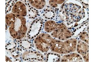 Image no. 18 for anti-EPM2A (Laforin) Interacting Protein 1 (EPM2AIP1) antibody (ABIN1498047) (EPM2AIP1 Antikörper)