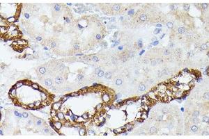 Immunohistochemistry of paraffin-embedded Rat kidney using LTF Polyclonal Antibody at dilution of 1:100 (40x lens). (Lactoferrin Antikörper)