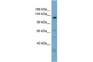Human ACHN; WB Suggested Anti-TMEM16C Antibody Titration: 0. (ANO3 Antikörper  (Middle Region))