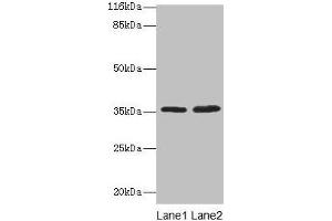 Western blot All lanes: ACKR1 antibody at 2 μg/mL Lane 1: Mouse kidney tissue Lane 2: Mouse spleen tissue Secondary Goat polyclonal to rabbit IgG at 1/10000 dilution Predicted band size: 36 kDa Observed band size: 36 kDa (DARC Antikörper  (AA 1-63))