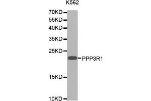 Western blot analysis of extracts of K-562 cells lines, using PPP3R1 antibody. (PPP3R1 Antikörper  (AA 11-170))