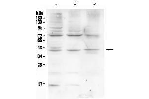 Western blot analysis of HFE using anti-HFE antibody . (HFE Antikörper  (AA 82-199))