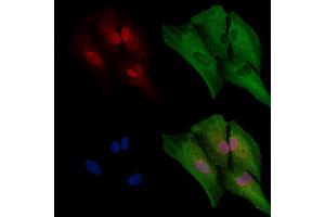 Phospho-NLRP6 (Ser109) Antibody staining A549 cells(4h of LPS treatment) by IF/ICC. (NLRP6 Antikörper  (pSer109))