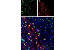 Expression of Ferroportin in mouse brain - Immunohistochemical staining of perfusion-fixed frozen mouse substantia nigra pars compacta (SNC) sections using Anti-Ferroportin (SLC40A1) Antibody (ABIN7043729, ABIN7044546 and ABIN7044547). (SLC40A1 Antikörper  (2nd Cytoplasmic Loop))