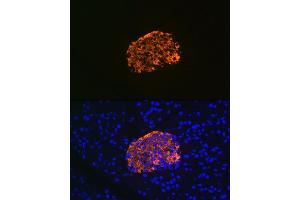 Immunofluorescence (IF) image for anti-Insulin-Like Growth Factor Binding Protein 7 (IGFBP7) antibody (ABIN7267910)