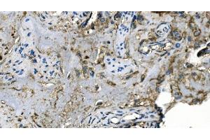IHC analysis of Carbonic Anhydrase I/CA1 using anti-Carbonic Anhydrase I/CA1 antibody (ABIN7602621). (CA1 Antikörper  (AA 9-261))
