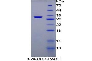 SDS-PAGE (SDS) image for serpin Peptidase Inhibitor, Clade D (Heparin Cofactor), Member 1 (SERPIND1) protein (ABIN3009826)