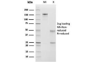 SDS-PAGE Analysis Purified Calponin-1 Mouse MAb (CNN1/832 + CALP). (CNN1 Antikörper)