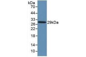 Detection of Recombinant TLR8, Human using Monoclonal Antibody to Toll Like Receptor 8 (TLR8) (TLR8 Antikörper  (AA 844-1039))
