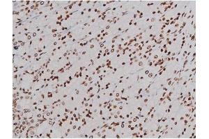 ABIN6256004 and ABIN6267365 at 1/200 staining Rat ganstric tissue sections by IHC-P. (KIT Antikörper  (pTyr721))