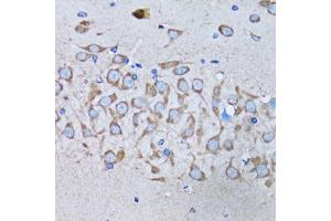 Immunohistochemistry of paraffin-embedded mouse brain using IRAK4 antibody. (IRAK4 Antikörper)