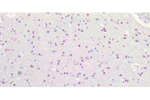 Immunohistochemistry of paraffin-embedded Human Brain using RBFOX3 Polyclonal Antibody at dilution of 1:100. (NeuN Antikörper)
