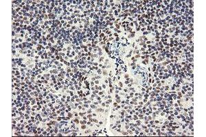 Image no. 4 for anti-SEC14 and Spectrin Domains 1 (SESTD1) antibody (ABIN1501066)