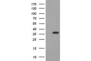 Western Blotting (WB) image for anti-Glyoxylate Reductase/hydroxypyruvate Reductase (GRHPR) antibody (ABIN1498520) (GRHPR Antikörper)
