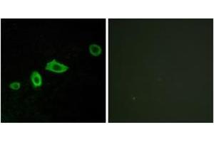 Immunofluorescence analysis of LOVO cells, using HTR5A Antibody. (Serotonin Receptor 5A Antikörper  (AA 15-64))