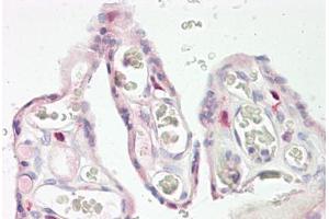 Image no. 2 for anti-Keratocan (KERA) (AA 196-245) antibody (ABIN1493172) (KERA Antikörper  (AA 196-245))