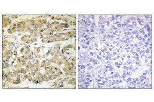 Immunohistochemistry (IHC) image for anti-14-3-3 zeta (YWHAZ) (pSer58) antibody (ABIN1847200) (14-3-3 zeta Antikörper  (pSer58))