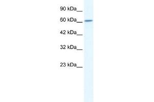 WB Suggested Anti-CUL5 Antibody Titration:  2. (Cullin 5 Antikörper  (C-Term))