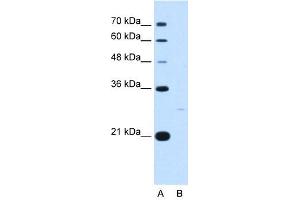 YWHAZ antibody used at 5 ug/ml to detect target protein. (14-3-3 zeta Antikörper  (C-Term))