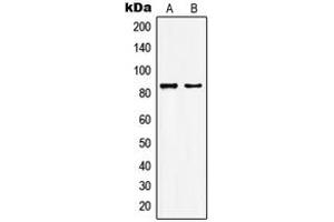 Western blot analysis of KAT7 expression in HepG2 (A), MCF7 (B) whole cell lysates. (MYST2 Antikörper  (Center))